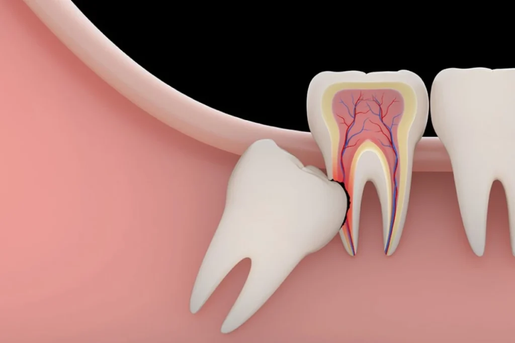 wisdom-teeth-symbolize